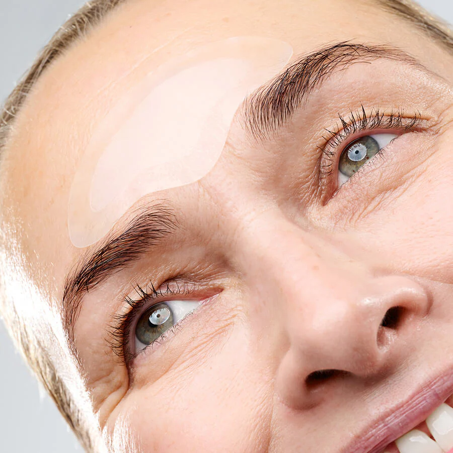 CurrentBody Skin RF Microneedling Treatment - Image 3