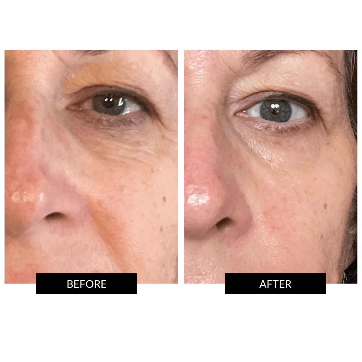 CurrentBody Skin Special LED Kit - Image 4